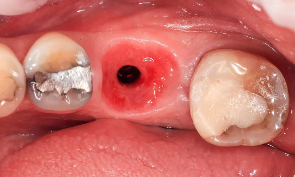 Before treatment