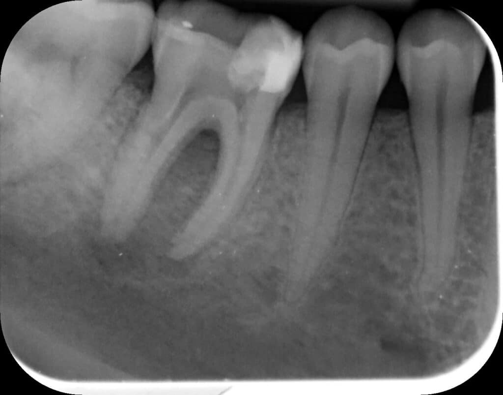 Before treatment