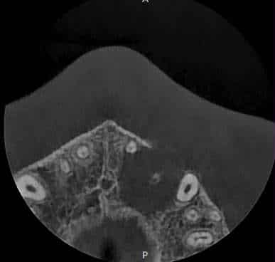 After treatment