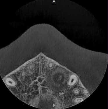 Before treatment