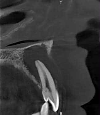 Before treatment