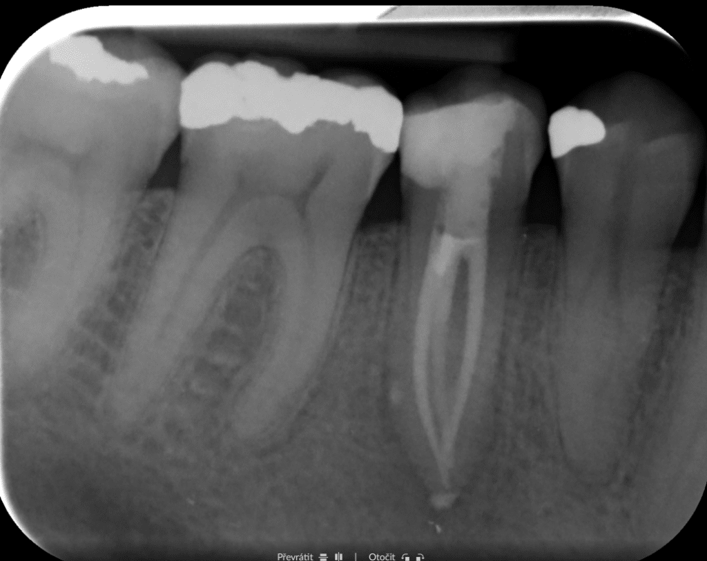 After treatment