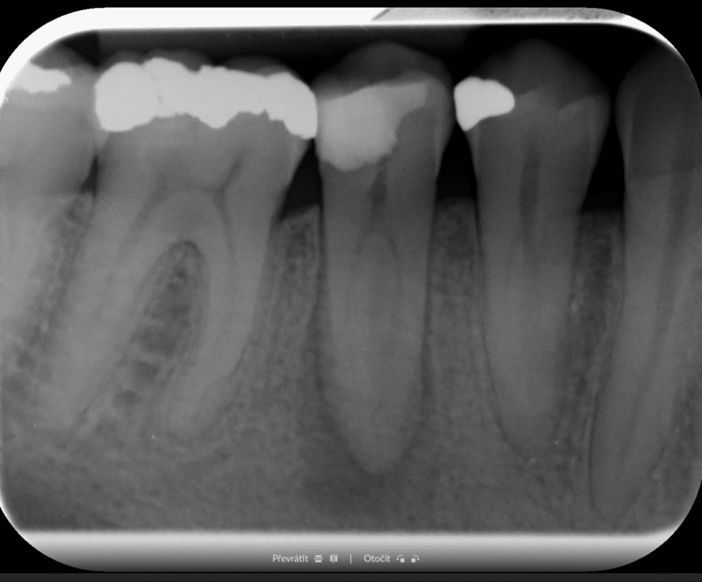 Before treatment