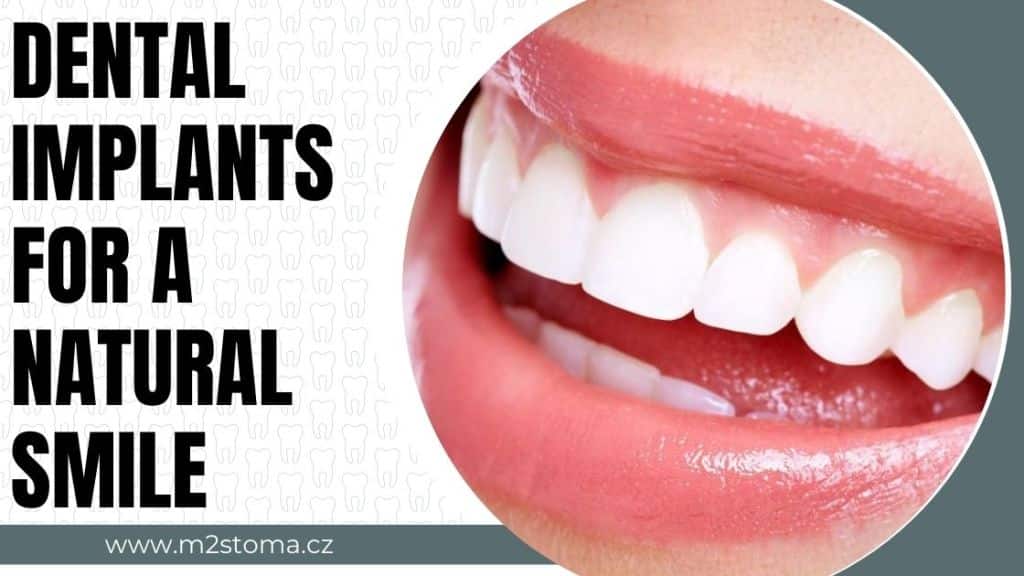 Dental implants for a natural smile