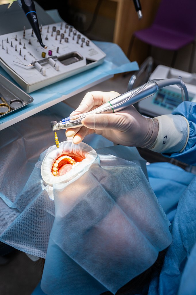 Detail zavádění zubního implantátu